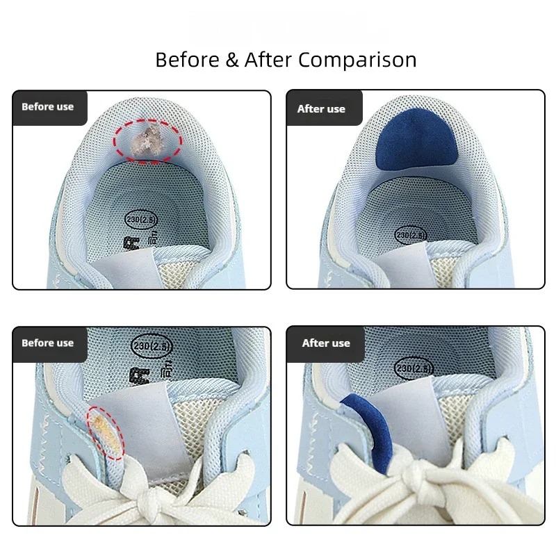 6 Stück Anti-Verschleiß-Schuhr – Sneaker Care Service Bewertung und Preis
